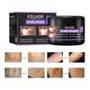 50g/Box Scar Repair Cream Quick Effect Body Care Tool Mild Universal Burn Old Wound Repair Cream for Adults