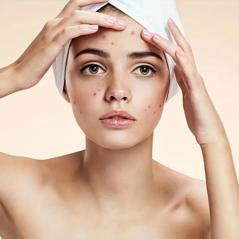 50/100/150/200 Pcs Blackhead Blemish Remover Tool, Ultra-fine Needle Pick Acne Easily Acne Stainless Steel Tools, Clean & Sanitary For Beauty Salon