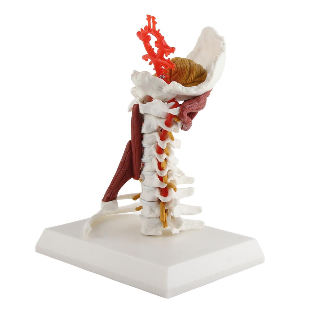 Cervical Spine Model Removable Human Spinal Nerves Model for Doctor Patient Communication Teaching Presentation