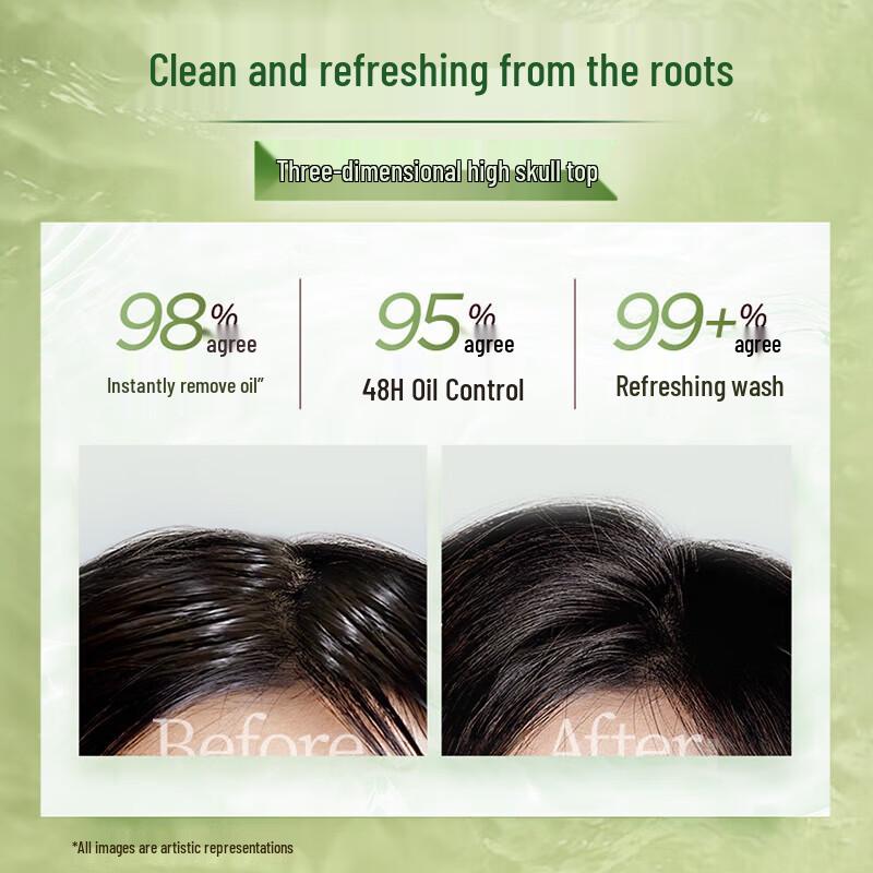 Schwarzkopf Ginger Scalp Repair & Anti-Dandruff Conditioner Triple Pack