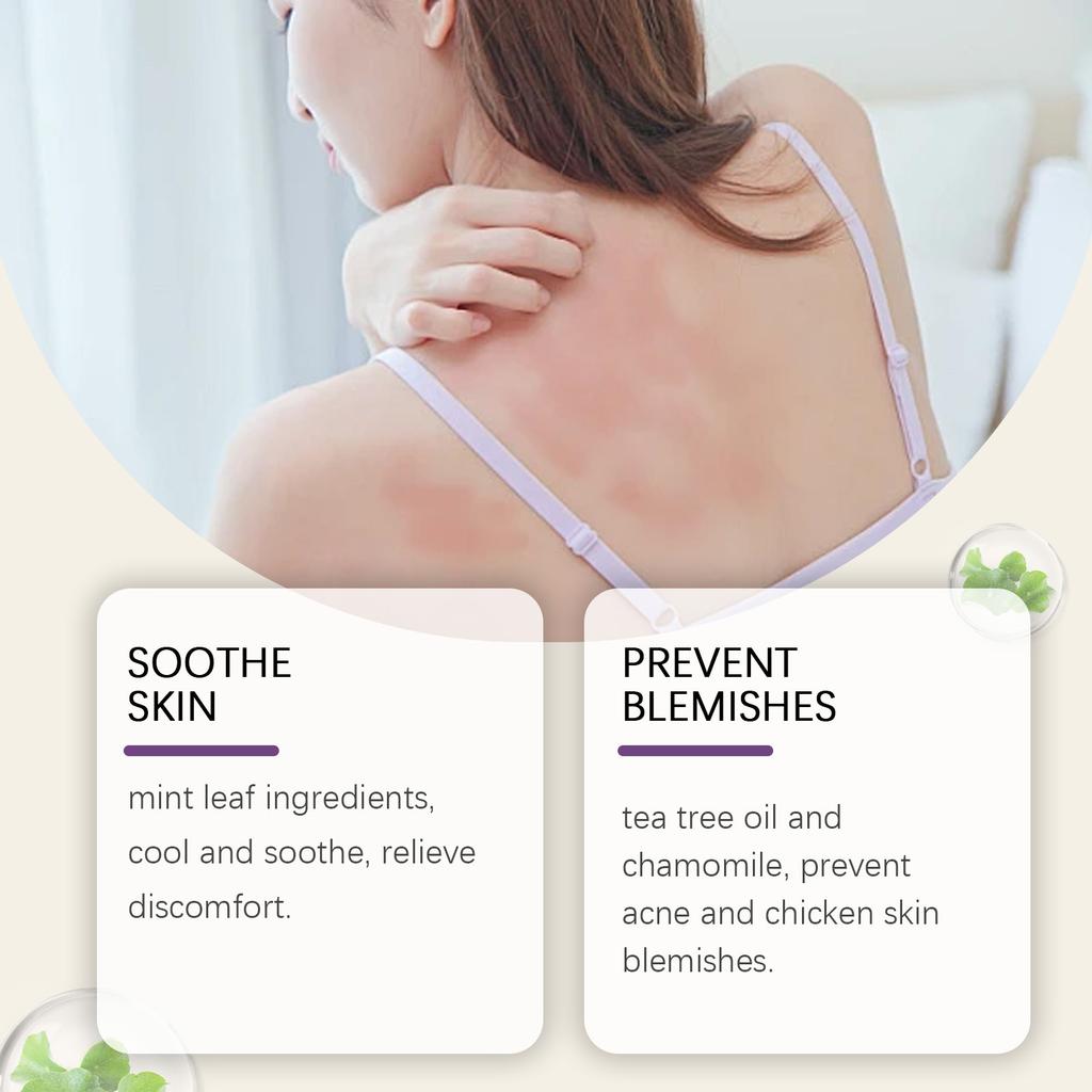 Успокаивающий спрей для кожи, Против акне, Снимает покраснение и зуд, Успокаивающая вода, Мягко успокаивает кожу без раздражения, 30 мл