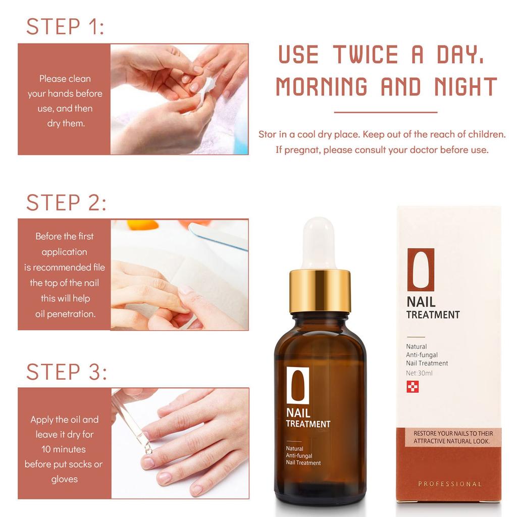 Крем-масло для ухода за ногтями, травяное растение, крем-масло для ухода за ногтями серого цвета для рук и ног, 30 мл