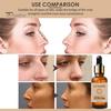 30ML Nose Repair Serum Firming Massage Gentle Ingredients Achieve Three-Dimensional Nose Shape Essence