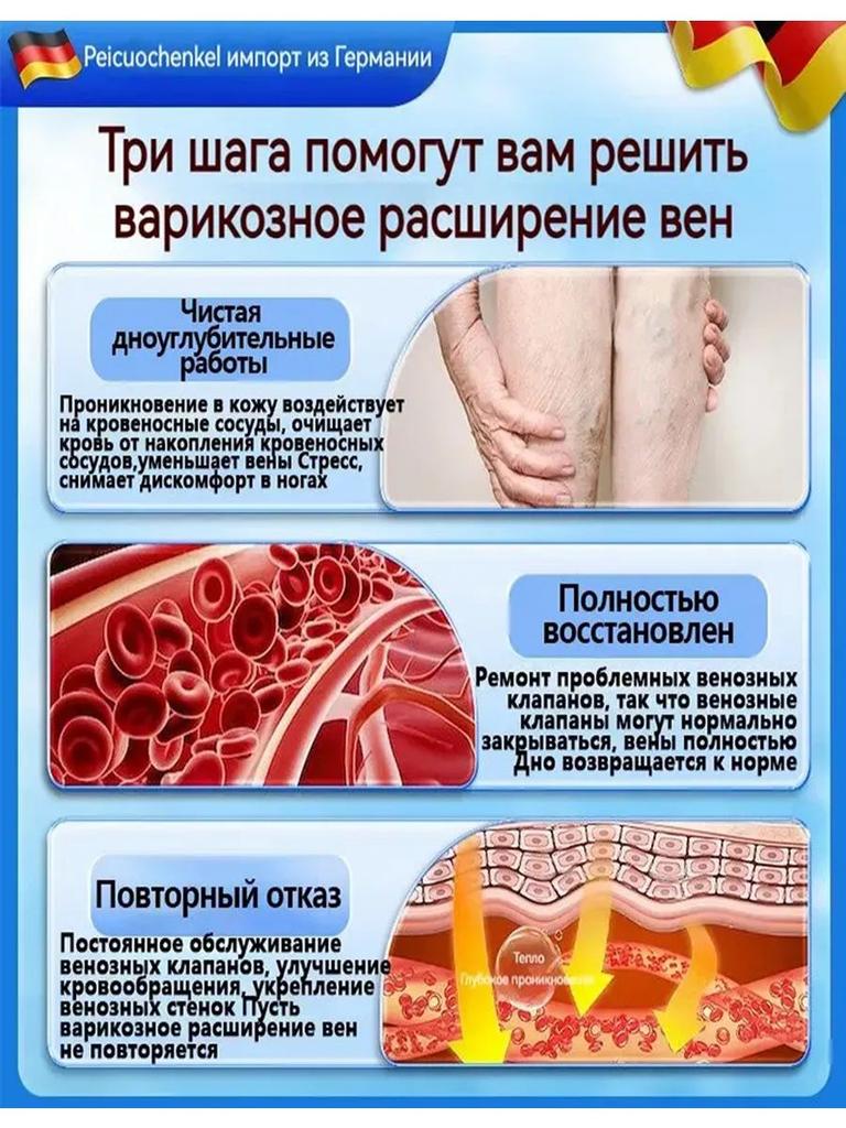 Гель от варикоза для ногМазь от варикоза, сосудистых звездочек и венозной сетки, крем для ног от отеков, тяжести и усталости, вен