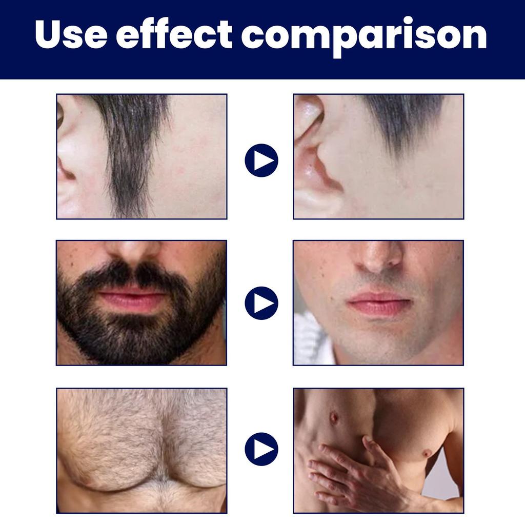 East-Moon Men'S Hair Removal-Cream, Gentle And Non Irritating For Removing Beard, Body, Armpit Hair, And Chest Hair