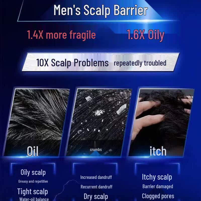CLEAR Men Scalp Expert Anti-Dandruff & Oil Control Shampoo