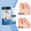 Foot Odor SprayAntibacterial Deodorant PowderAnti Itch Sweat Odor Feet Athletes Foot Liquid Anti-Fungi Shoe Sock Feet Care