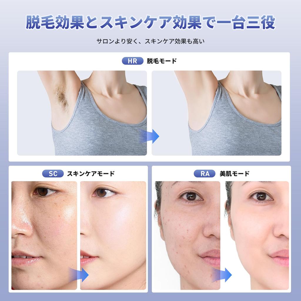 YUDOFICAL Удаление волос Холодное ощущение Удаление волос IPL Свет Устройство для удаления волос для VIO 9 Уровни облучения Устройство для удаления волос для и Волосы полностью