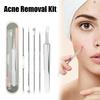 5pcs Acne Blackhead Removal Kit Steel Extraction Acne Pimple Comedone Blemish Extract U5Z7