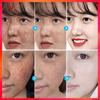 Newest Dark Spots Corrector Cream Whitening Facial Cream Repair Fade Freckles Remove Dark Spots Melanin Remover Brightening Face Cream