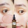 Pore Shrinking Serum Face Removing Large Pores Tightening Whitening Repairing Facial Pore Minimizing Essence Skin Care Beauty