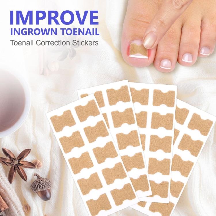 100pcs Paronychia Toenail Corrector Ingrown Patch Foot Care Nail Repair Patch