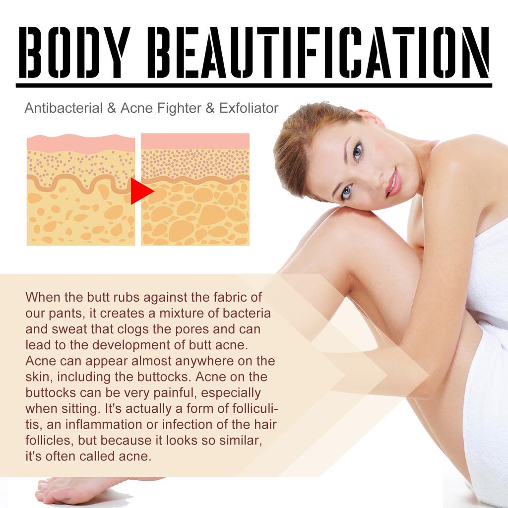 2023 Skin Care Body Fashion Care Health Hip Care Cream Relieves Rough and Itchy Buttocks Gently Nourishes and Moisturizes The Skin