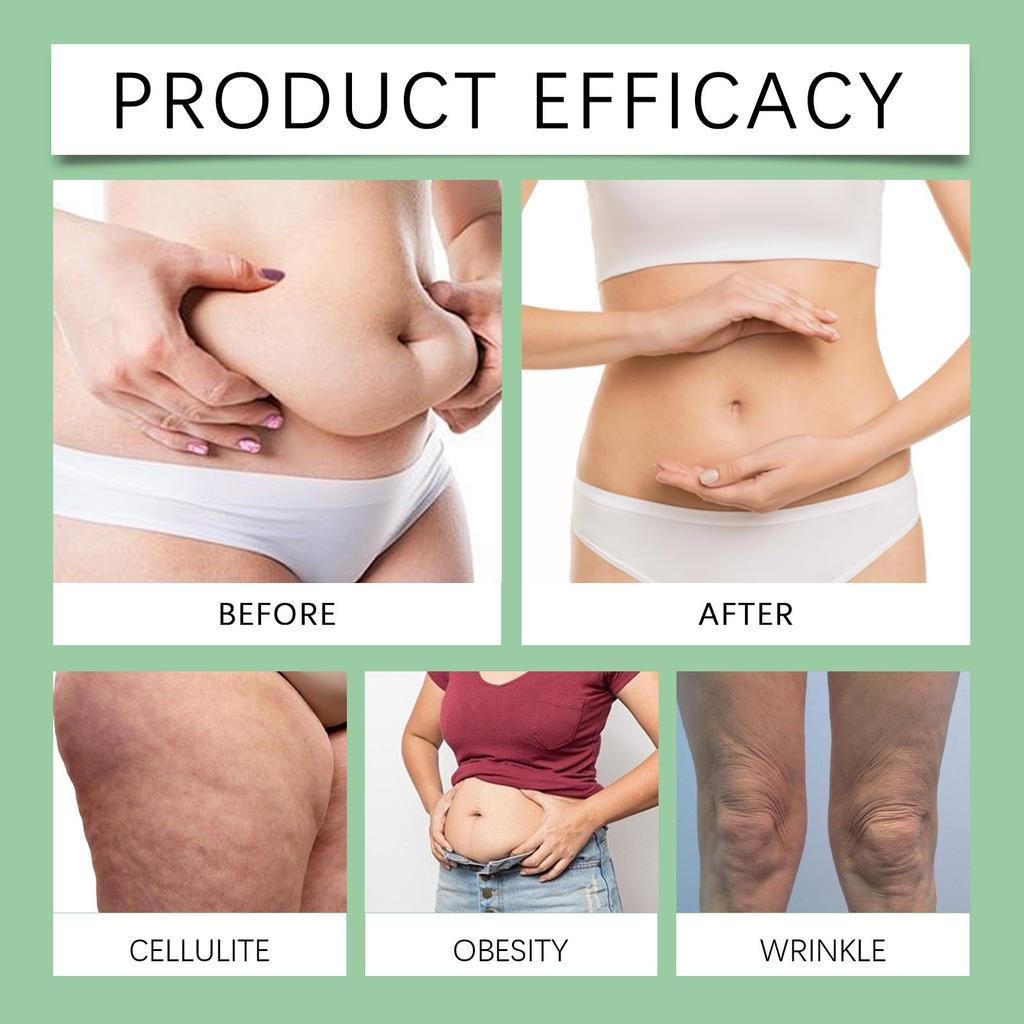 Увлажняющий и питательный массаж, коррекция фигуры, коррекция фигуры, увлажняющий лифтинг-бар против морщин