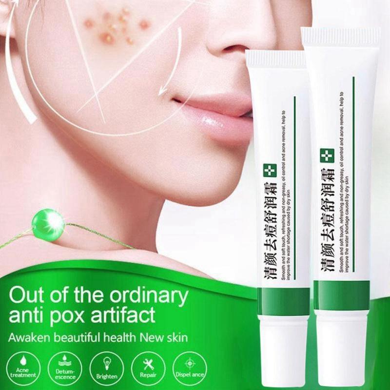 Крем для удаления прыщей, крем от веснушек, сужающий поры, отбеливающий, увлажняющий, контроль жирности, крем от прыщей, уход за кожей, лечение прыщей, крем для лица