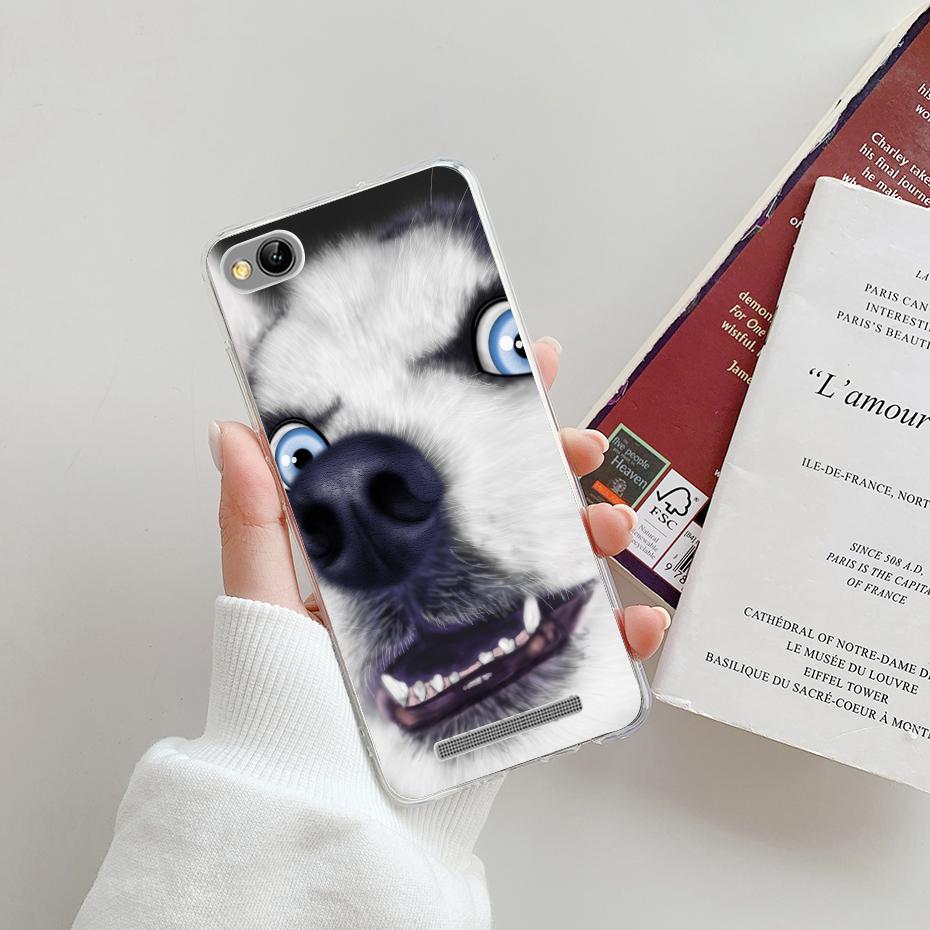 Чехол для Xiaomi Redmi 5A 5,0 дюйма, прозрачный, окрашенный, мягкий силикон TPU, чехлы-бамперы для телефона Xiaomi Redmi 5A, задняя крышка для Redmi 5A