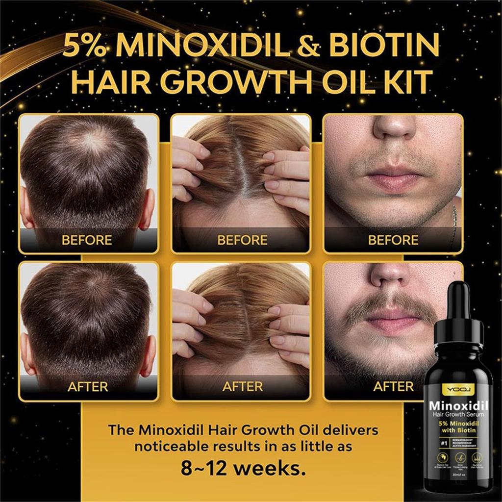 5% Minoxidil Hair Growth  For Men And Women - Infused With Biotin, Niacinamide And Panthenol