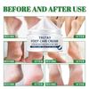 Foot Care Cream Replenishes Moisture, Repairs Damaged Foot Skin, Nourishes, Whitens, and Even Skin Tone, Moisturizing and Repairing Cream
