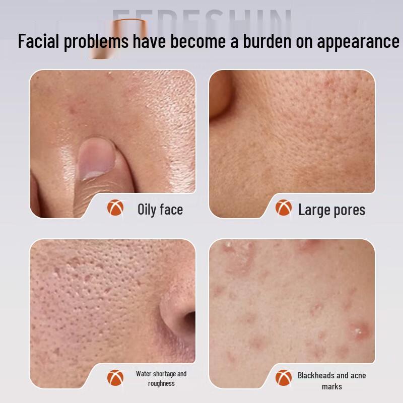 Renhe Jiangxin Men's Oil Control Facial Cleanser