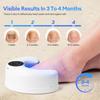 Wireless Hand Foot Nail Nail Fungus Laser Device Toenail Fungus Treatment Lamp Infrared Blue Light Anti Fungal Laser Nail Lamp