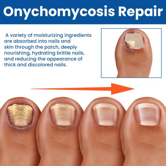 60Pcs/Box Nail Repair Patches Nail Repair Treatment Restores Damaged Nails and Appearance