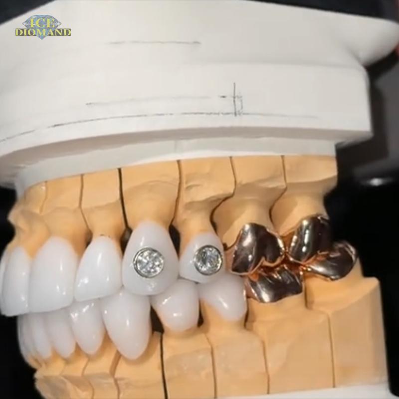 Индивидуальные Grillz Из стерлингового серебра S925 с золотым покрытием Хип-хоп Ледяные VVS Муассанит Мужские для зубов