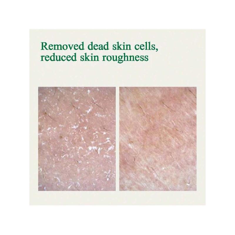 Ампула Pyunkang Yul Ultimate Calming Solution для чувствительной кожи с запатентованными ингредиентами, сыворотка интенсивно успокаивает (30мл)