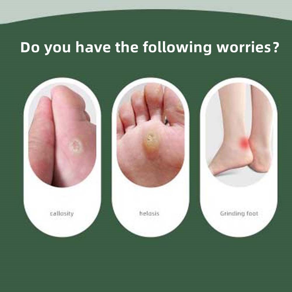 Войлочные подушечки для пальцев, защита от бурсита стопы, подушечки для мозолей, подушечки для мозолей, противоизносные наклейки для ног