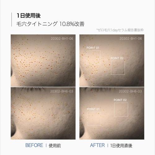 Medicube Zero Pore One Day Serum 30ml MedicubeZero Pore One Day Serum 30ml Korean Cosmetics Rough Skin Care Sensitive Skin Hypoallergenic Skin Care Por