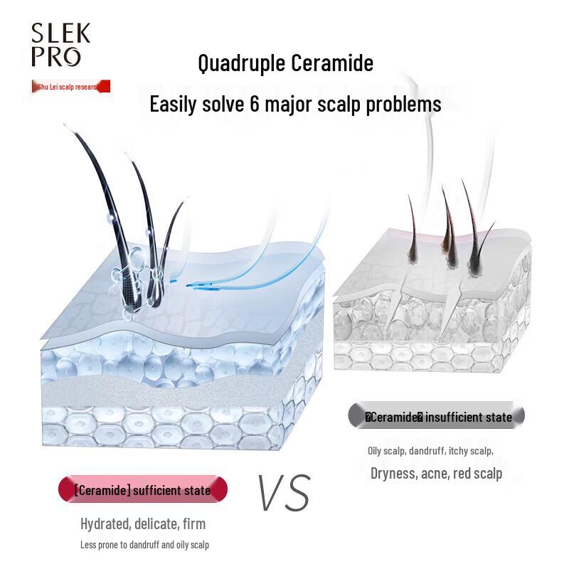 Shu Lei PRO Anti-Dandruff Scalp Care 4-Piece Gift Set