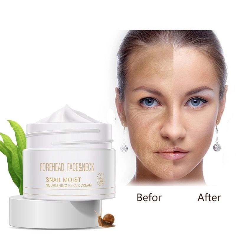 Крем для удаления и отбеливания морщин улитки