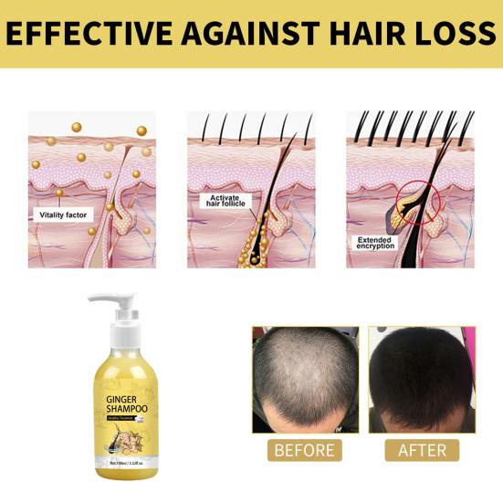 100 мл Уход за волосами Шампунь для придания объема Устранение зуда Против перхоти Защита волос Питательный имбирный кондиционер для роста волос Шампунь Принадлежности для волос