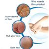 4-Piece Double-Sided Foot Pumice Stones, 2-in-1 Callus Remover Pads, Pedicure Stone Scrub for Hard Skin, Callus Remover for Feet and Hands