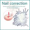 10Pcs Ingrown Toenail Correction Tool Toe Nail Treatment Elastic Patch Sticker