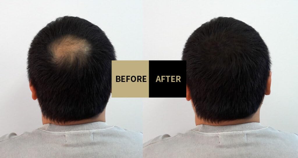 Lalachuu Hair Foundation Premium N Dark Brown Light Brown Body lalachuu Скрывает седину, увеличивает, скрывает истончение волос, увеличивает облысение по линии роста волос