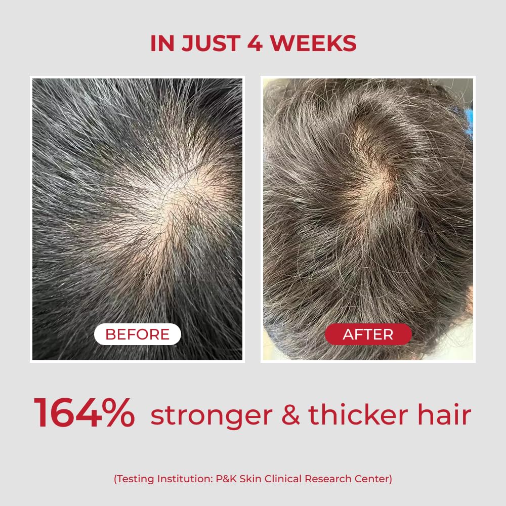 moev ANNURCATIN Шампунь Корейское яблоко Уход за волосами для силы и объема при истончении