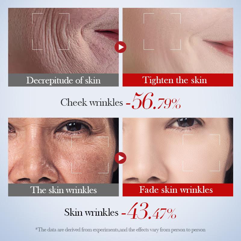 SADOER Увлажняющая увлажняющая сыворотка с коллагеном улитки против морщин