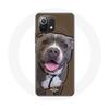 Case - Xiaomi - Mi 11 Lite - Flexible - Pitbull Dog - White and Gray
