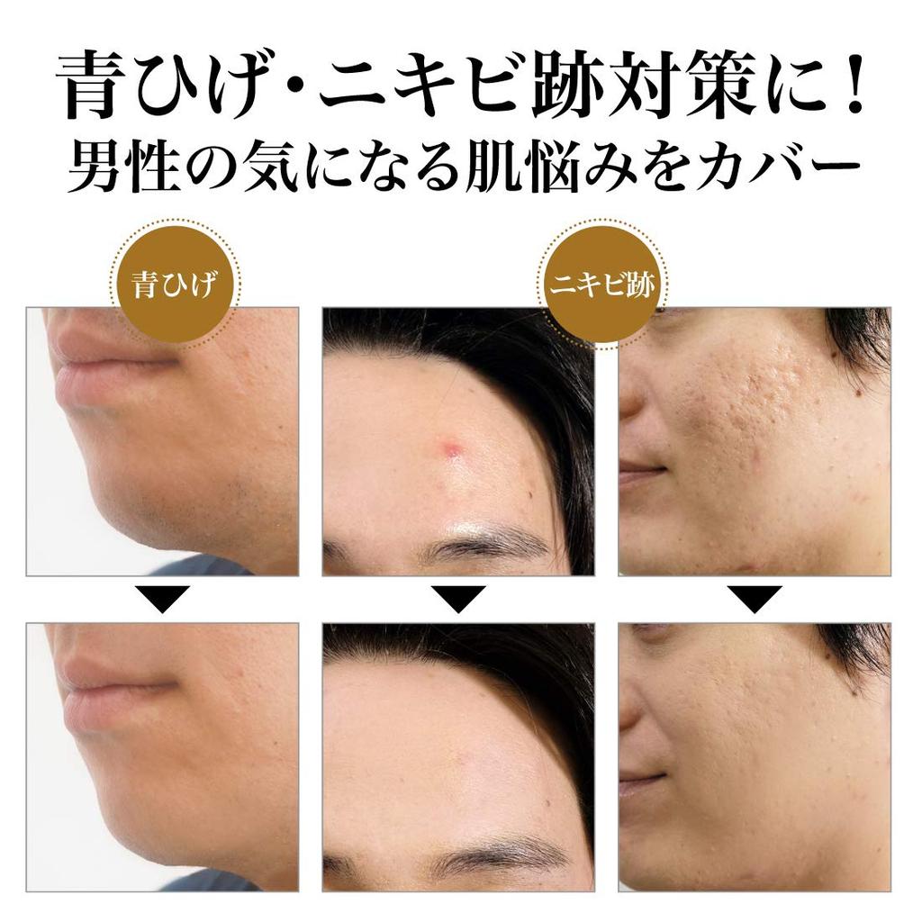 BB-крем SPF15 Тональный крем для проблемной кожи и для мужчин со средней кожей, 30 г, PA+, Без отдушек (Акне типа суфле, Шрамы, Шрамы) [Фитограмма]