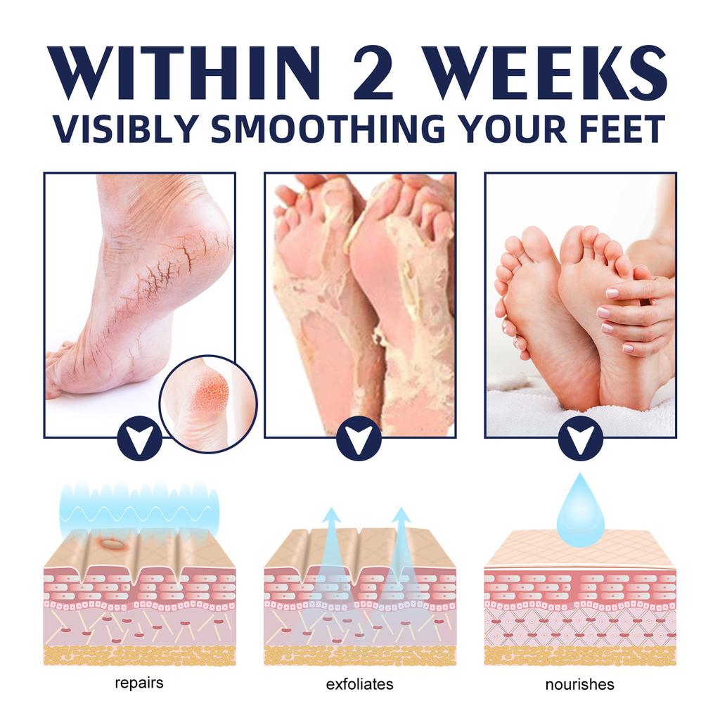 Увлажняющий крем для рук и ног для потрескавшейся и огрубевшей кожи, восстанавливающий и питательный крем для рук