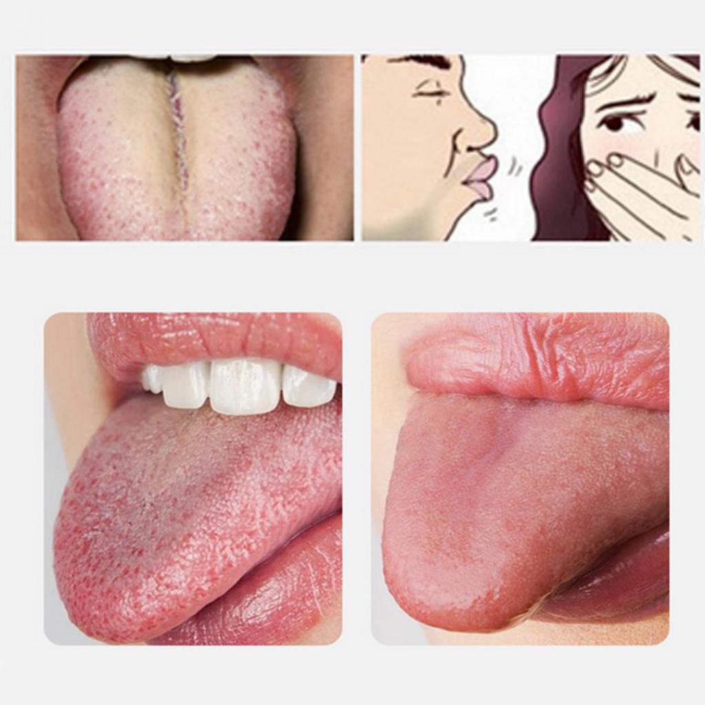 Безопасный скребок для языка из нержавеющей стали, очиститель для удаления налета, средство для свежего дыхания