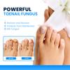 Sumifun Nail Fungus Treatment Cream, Antifungal Nail Repair Cream for Toenail and Fingernail Fungus