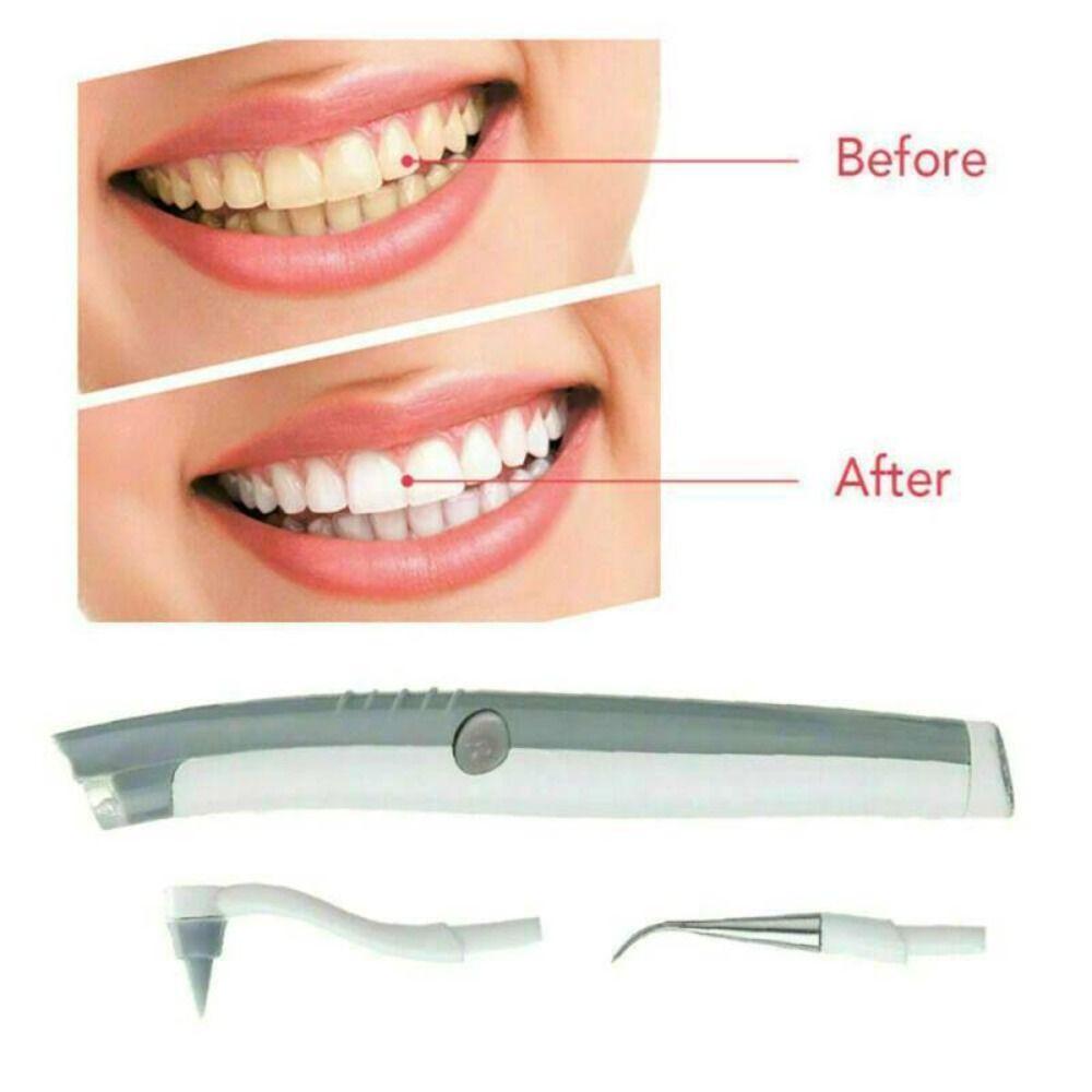 Отбеливание зубов Средство для чистки зубов Удаление зубного камня Звуковой скалер Акустический очиститель зубов
