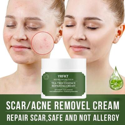 Крем для удаления прыщей, отбеливающий, исчезающих пятен, крем для удаления шрамов от прыщей, восстановление шрамов от прыщей, сужение пор, уход за кожей