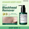 Bye Bye Black head 30 Days Miracle Green Tea Tox Bubble Cleanser 120г