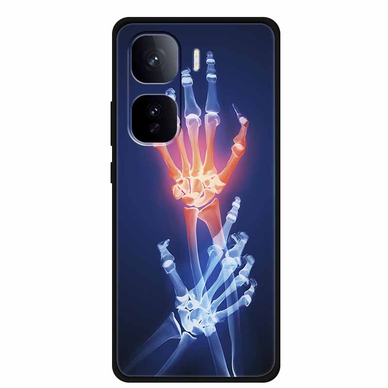 Задняя крышка для Vivo iQOO Neo 10 Plus Чехол 10Pro Черный ТПУ Силикон Мягкий Funda Сумка Для Vivo iQOO Neo 10 Pro Чехол Neo10 Pro Coque