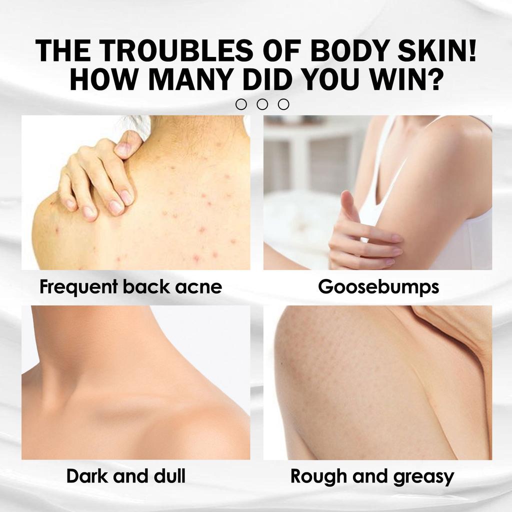 Ультраувлажняющий лосьон для тела для гладкой и сияющей кожи, восстановление куриной кожи и осветление кожи