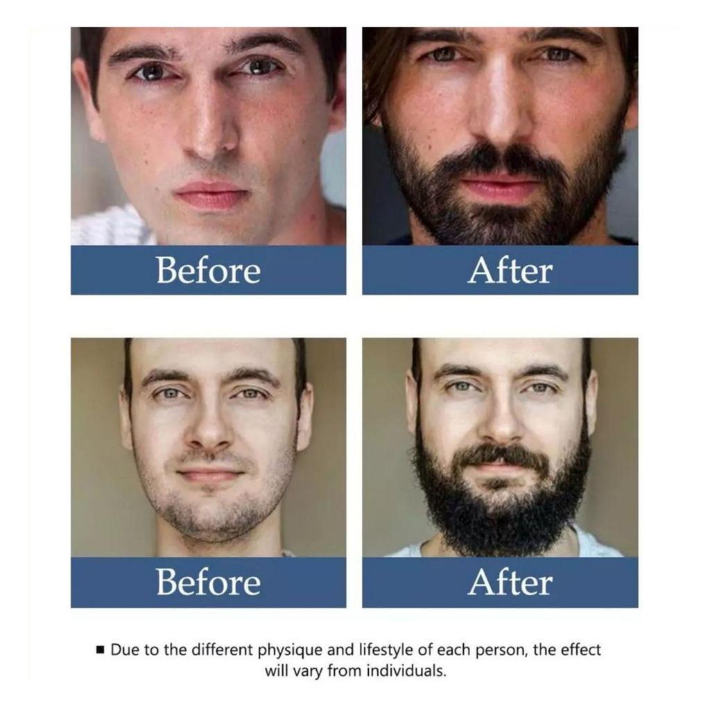 Beard Oil Hair Oil for Fast Hair Growth Beard Growth Hair Growth Oil