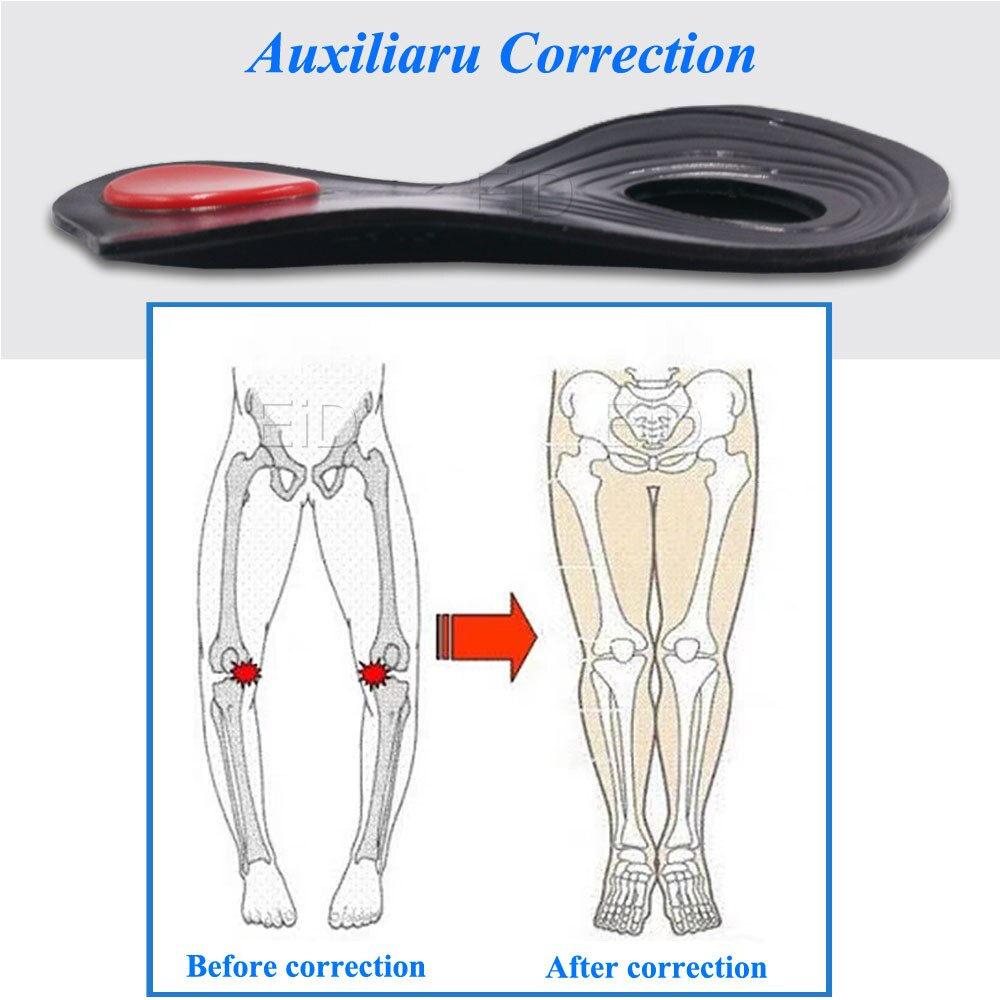 Flat Feet O / X Feet Corrector Orthopedic Insoles Arch Orthoses Massage Pad Shoes Foot Care Shoes
