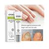 3x Efero Nail Exfoliation Plant Nail Repair Fluid Nail Cream Nail Treatment Gel Nail Repair Gel Moisturizing Nail Luster Tw